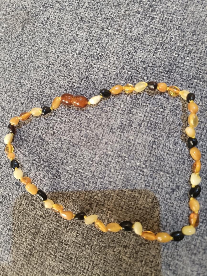 Amber Dentition Necklace
